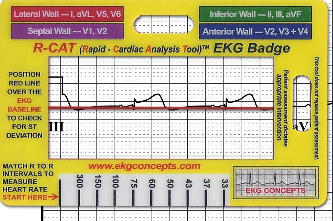 Best Ekg Calipers